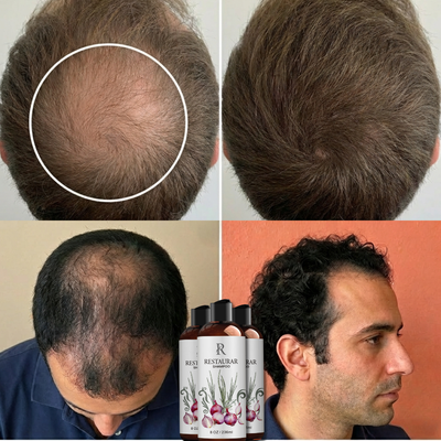 RESTAURAR™ -  Restaura, Fortalece y Regenera tu Cabello
