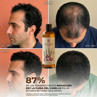 Resultados Visibles, Garantizados