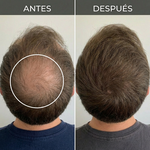 Sistema Completo de 90 Días